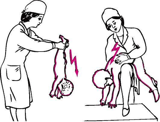 Ребенок проглотил инородный предмет