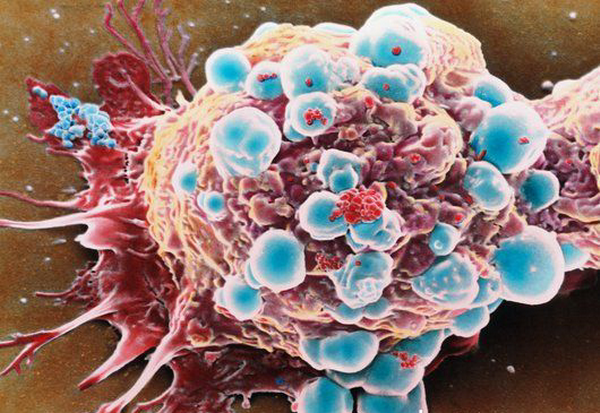 Рост раковых заболеваний