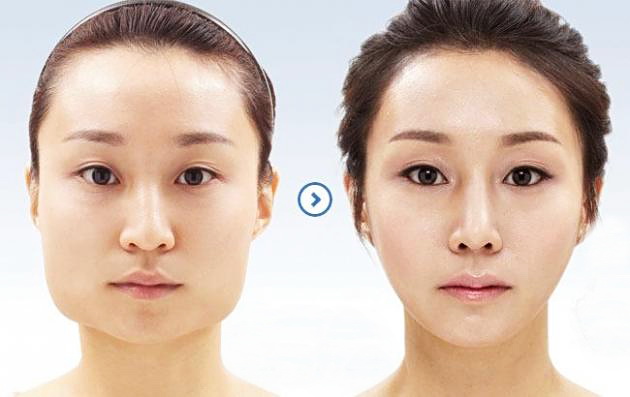 Пластическая хирургия в Корее